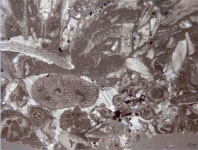 Skeletal - Bryozoan through Coccoliths